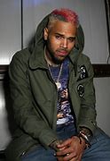 Image result for Chris Brown Hair Transplant