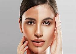 Image result for Natural Face Whitening