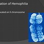 Image result for Hemophilia Punnett Square
