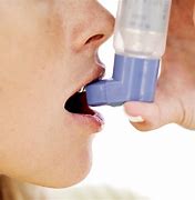 Image result for Asthma Treatment Inhaler