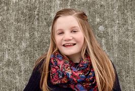 Image result for Girls with Turner Syndrome Symptoms
