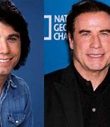 Image result for John Travolta Botox