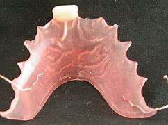 Image result for temporary dental flipper