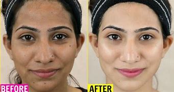 Image result for Skin Whitening Pills Before and After