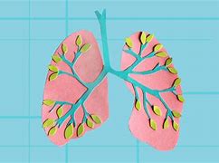 Image result for Stage 4 Lung Cancer Picture