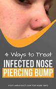 Image result for Infected Nose Piercing