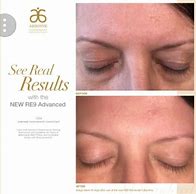 Image result for results from re9 skin care line