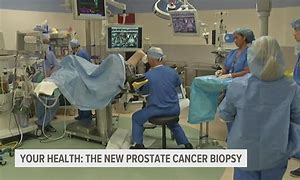 Image result for Prostate Biopsy Procedure