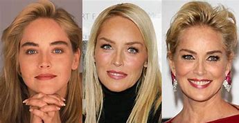 Image result for Sharon Stone Facelift