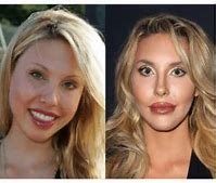 Image result for Chloe Lattanzi Before and After