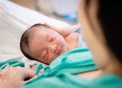 Image result for Birth Defect Hypospadias Newborn