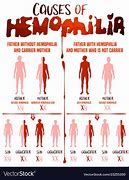 Image result for Hemophilia Drawing