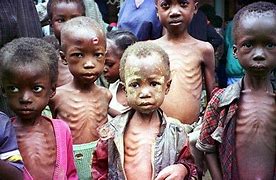 Image result for people who are starving