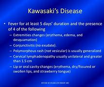 Image result for Kawasaki Disease Mnemonic