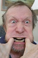 Image result for Dirty Teeth