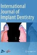 Image result for Implant Dentistry