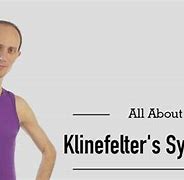 Image result for Klinefelder S Syndrome