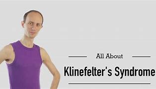 Image result for Klinefelter Syndrome Patients