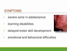 Image result for Jacobs Syndrome Symptoms