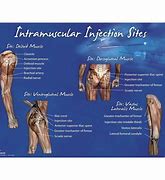 Image result for Intramuscular Injection Sites for Adults