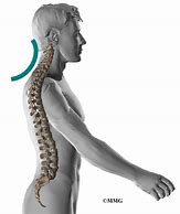 Image result for Neck Pain Anatomy