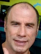 Image result for John Travolta Going Bald