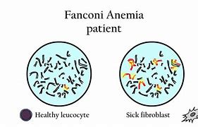 Image result for Treating Fanconi Anemia