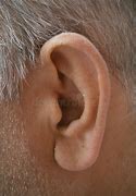 Image result for Healthy Ear