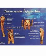 Image result for Intramuscular Injection Site Wall Charts