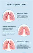 Image result for Stage 2 COPD