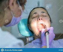 Image result for Mock Up Dental