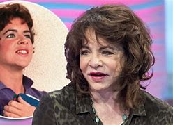 Image result for Stockard Channing Plastic Surgery Disasters