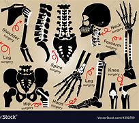 Image result for Orthopedics Anatomy Gallery