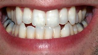 Image result for Random Tooth Facts