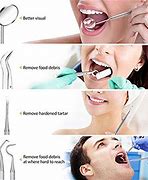 Image result for How to Use Dental Scaler at Home