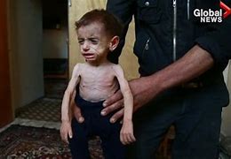 Image result for Syria Baby