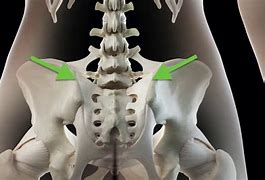 Image result for Sacroiliac Joint Pain