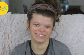 Image result for People Who Have Williams Syndrome