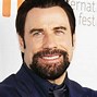 Image result for John Travolta Before After Surgery