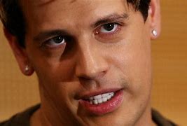 Image result for Milo Yiannopoulos Teeth