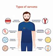 Image result for Sarcoma