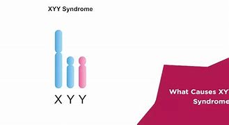 Image result for XYY Chromosome Symptoms