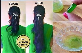 Image result for Vitamin E Hair Growth