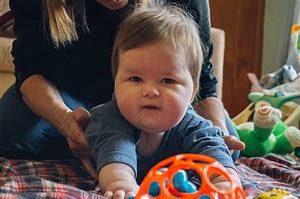 Image result for Pictures Toddlers Prader-Willi Syndrome