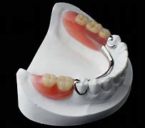 Image result for 2 Dents