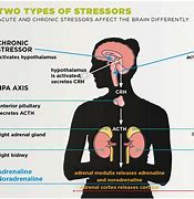 Image result for Acute Episodic and Chronic Stress