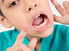 Image result for How to Floss with Braces Cartoon