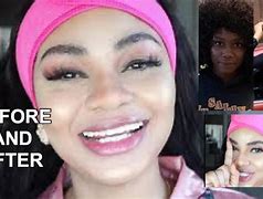 Image result for What Is Skin Bleaching