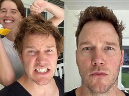 Image result for Chris Pratt Hair Loss