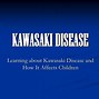 Image result for Kawasaki Disease Signs